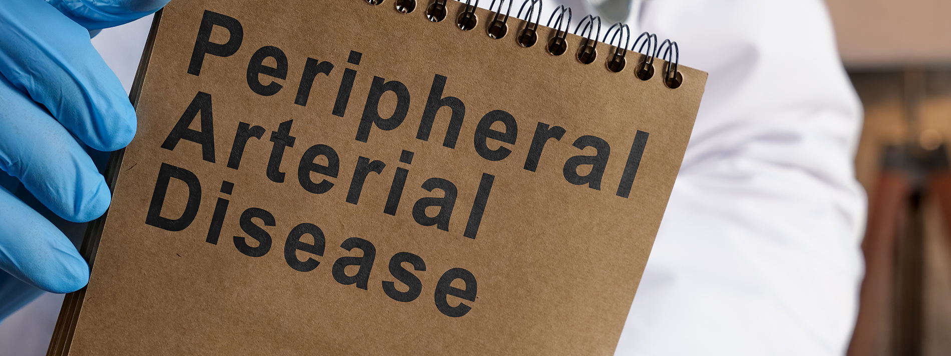 4 Risk Signs of Peripheral Arterial Disease Everyone Should Look Out For